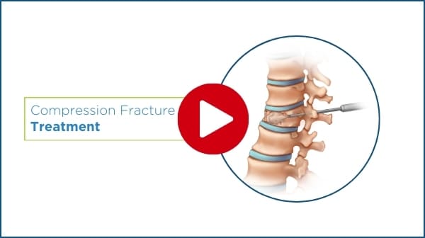 play compression fracture video